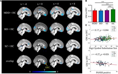 Reduced Gray Matter Volume in Orbitofrontal Cortex Across Schizophrenia, Major Depressive Disorder, and Bipolar Disorder: A Comparative Imaging Study